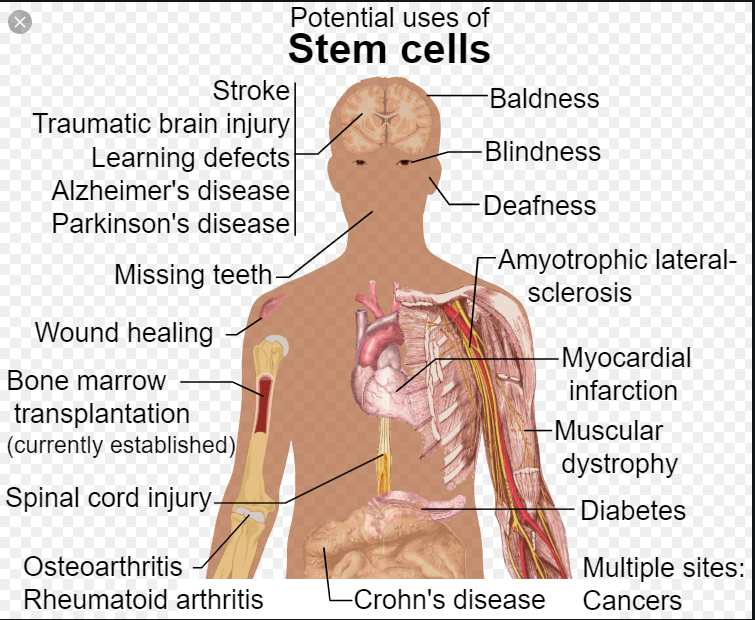 [:en]Other diseases[:km]ជម្ងឺផ្សេងៗទៀត[:]