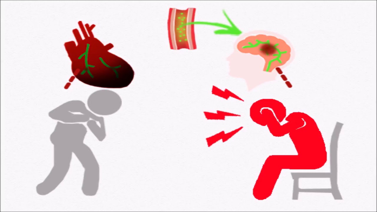 [:en]Stem cells and type 2 diabetes[:km]ស្តឹមសែលនិងជម្ងឺទឹកនោមផ្អែមប្រភេទទី២[:]