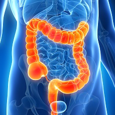 រលាកពោះវៀនធំ (Colitis)