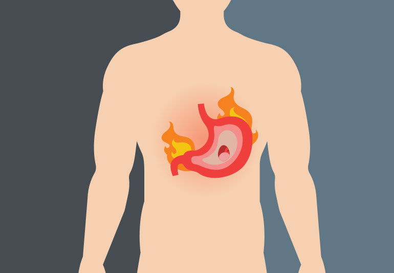 ជំងឺរលាកក្រពះ (Gastritis)