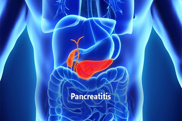 ជំងឺរលាកលំពែង (Pancreatitis)