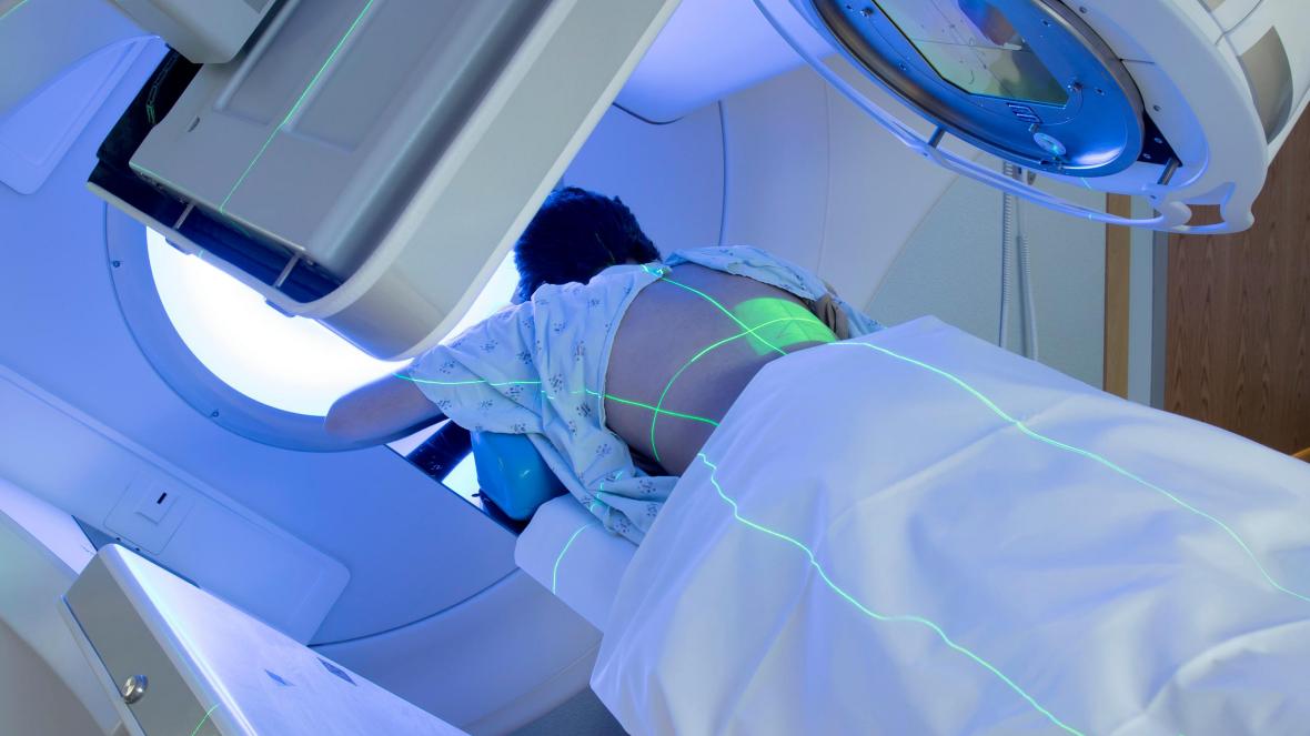 ការបាញ់កាំរស្មី (Radiation)