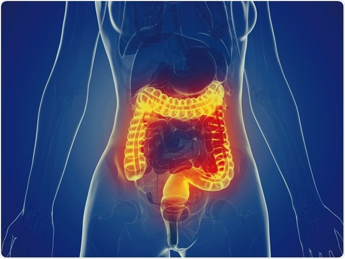 ជំងឺរលាកពោះវៀន (Inflammatory Bowel Disease – IBD)